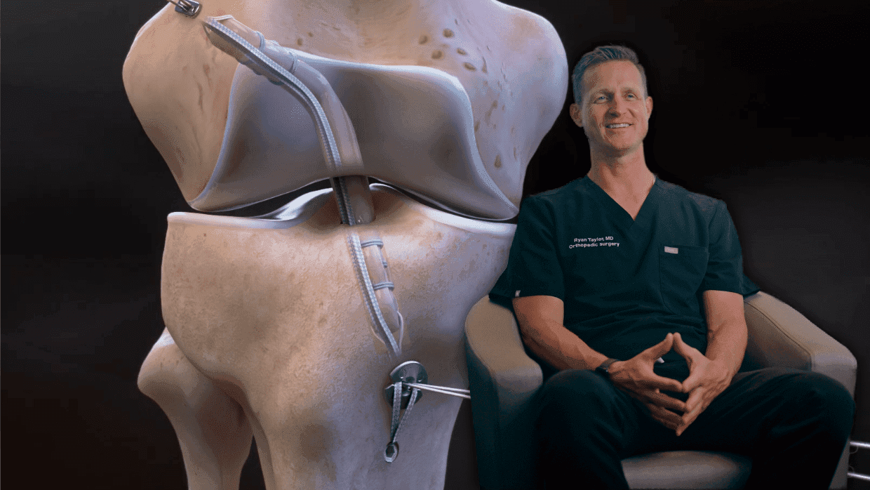 Thumbnail for Knee: ACL