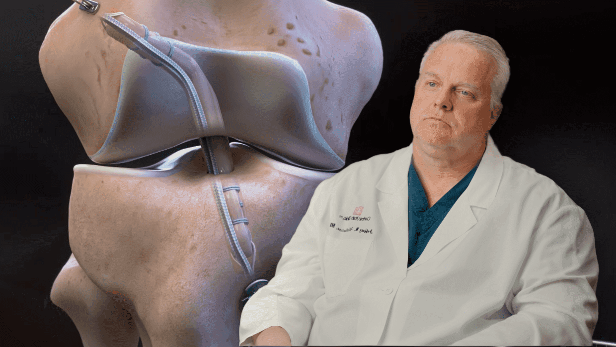 Thumbnail for Knee: ACL