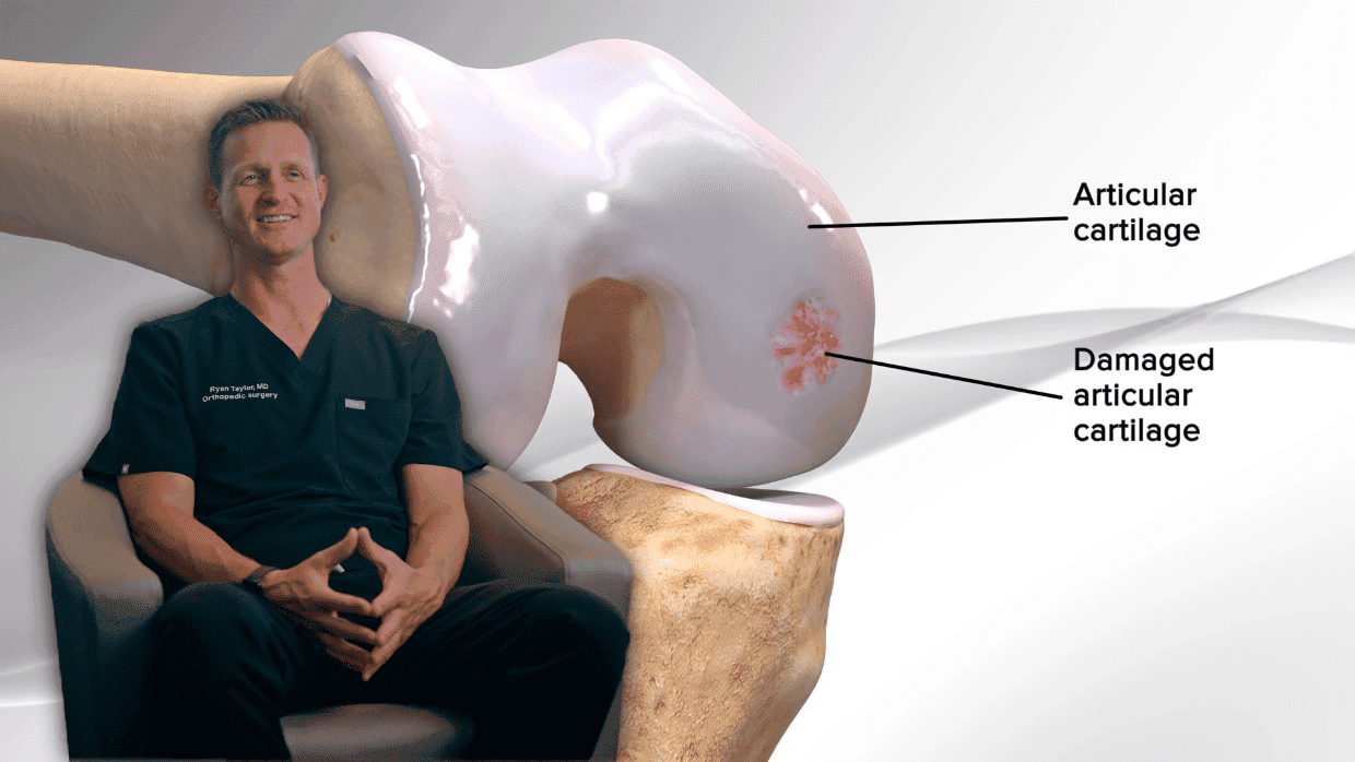 Thumbnail for Cartilage