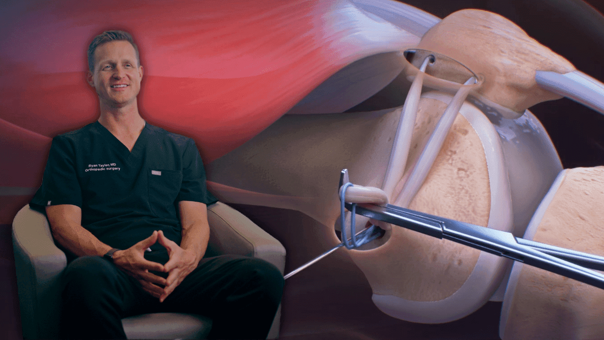 Thumbnail for Knee: MPFL
