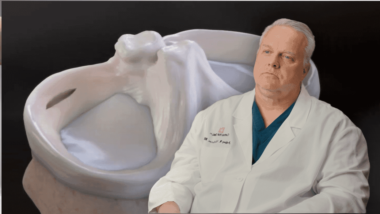 Thumbnail for Knee: Meniscus