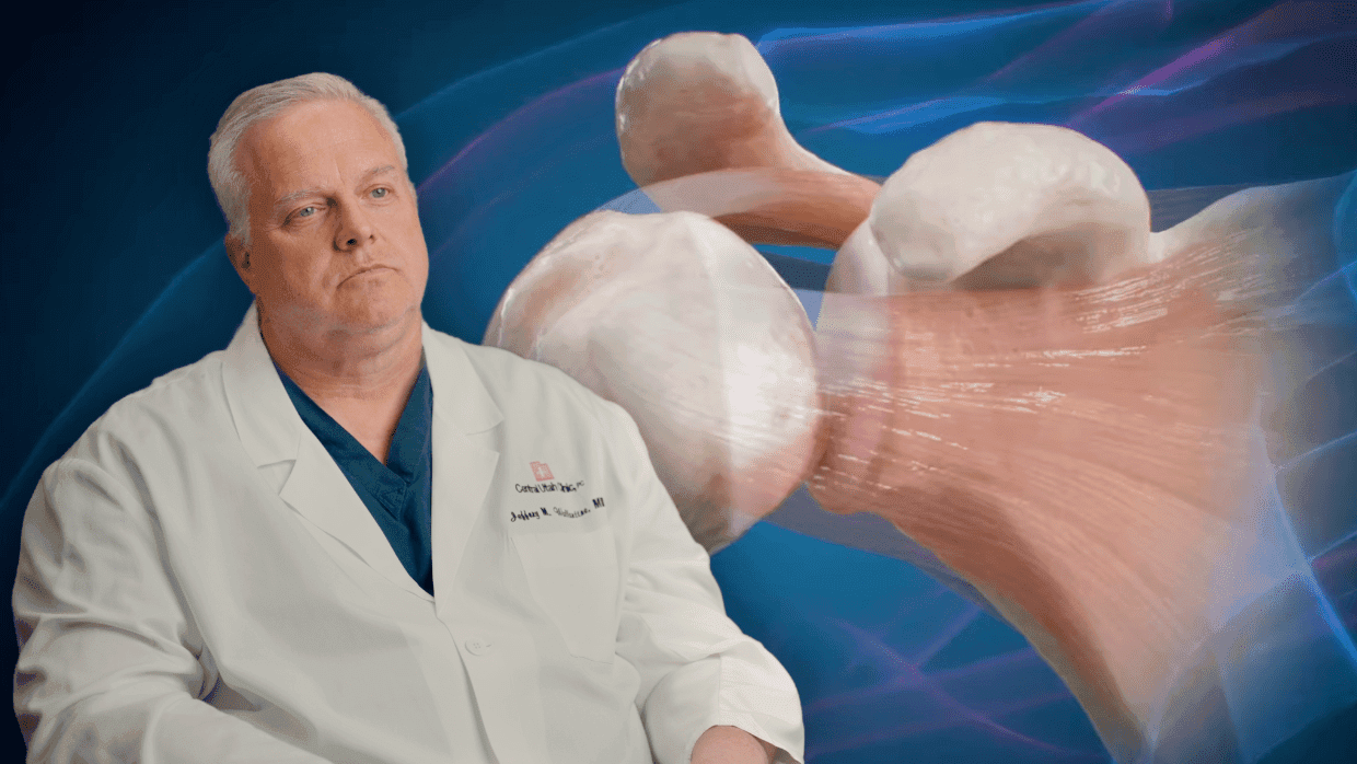 Thumbnail for Shoulder: Rotator Cuff