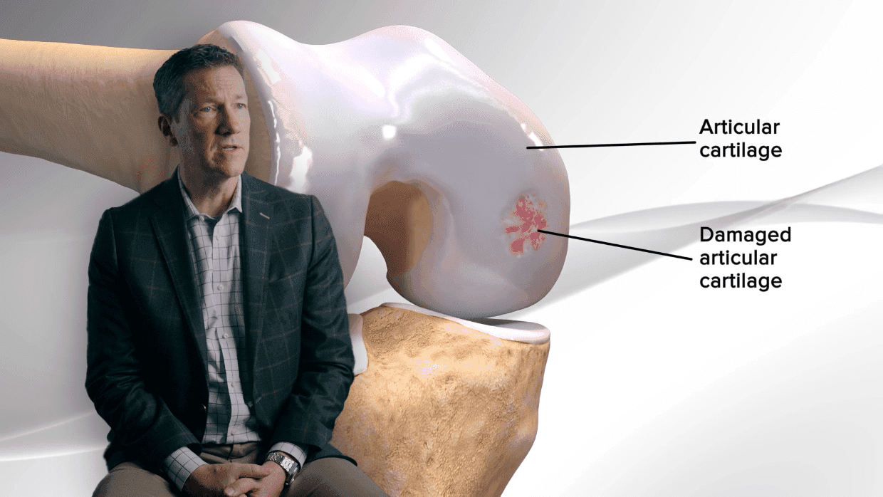 Thumbnail for Knee: Cartilage