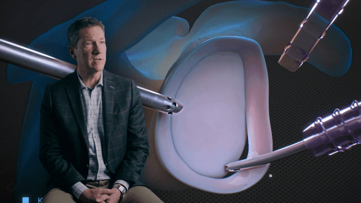 Thumbnail for Shoulder: Labral Repair